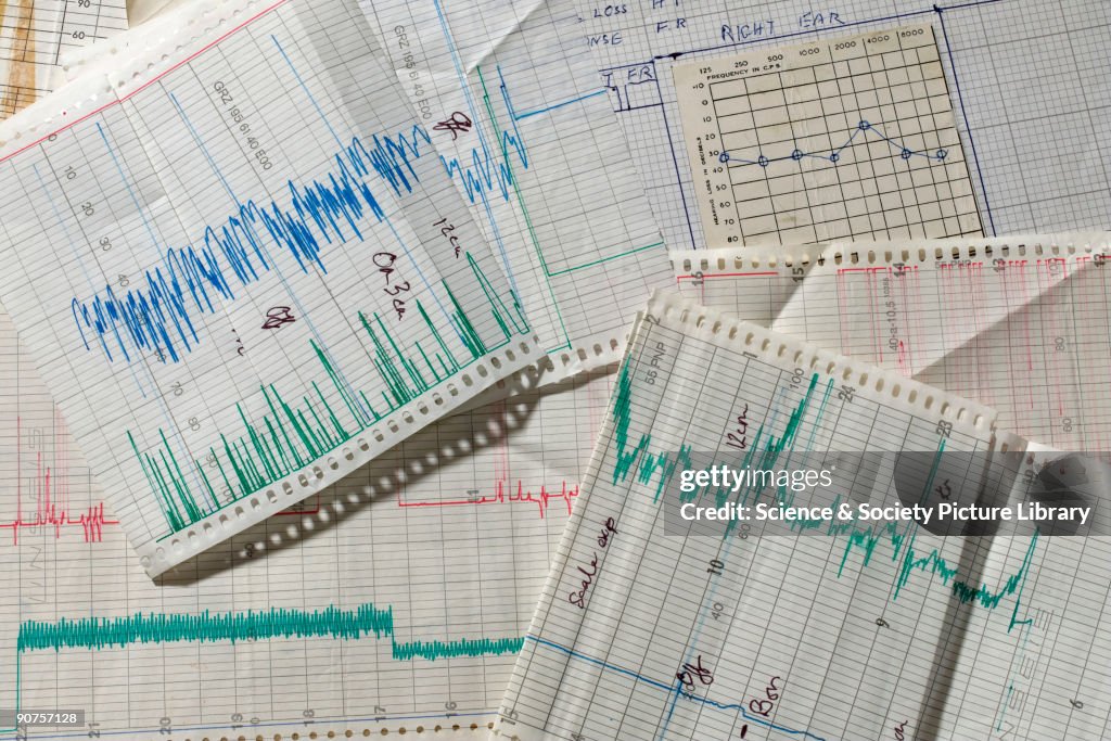 Papers on hearing and central nervous system of unborn babies, c 1970-1980.