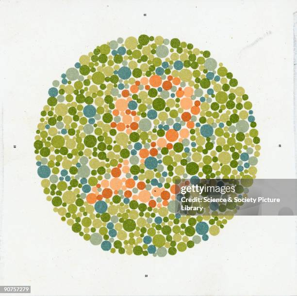 Most colour blindness is inherited, and affects more men than women. Colour blindness usually involves confusion between red, green and yellow. Dr...