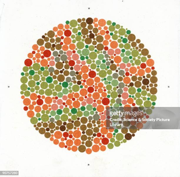 Most colour blindness is inherited, and affects more men than women. Colour blindness usually involves confusion between red, green and yellow. Dr...