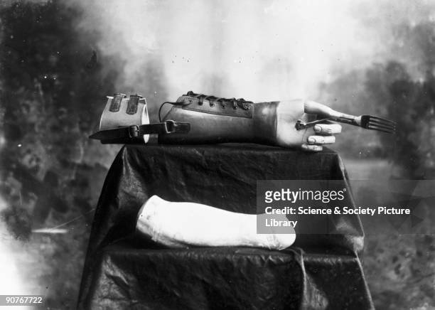 Studio photograph of an artificial arm and a plaster cast of the wearer's arm stump, used to ensure a correct fit. The arm was manufactured by James...