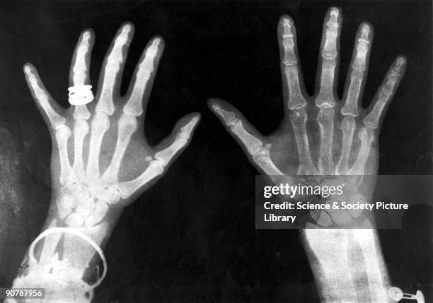 Plate from the Illustrated London News. The X-ray or 'new' photography caused a sensation when it was discovered by German scientist Professor...