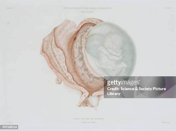 Engraved colour plate by Protais, showing a human foetus at four months of development. From the atlas edition of �Histoire Generale et Particuliere...