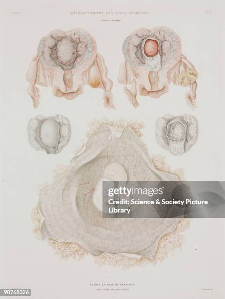 Engraved colour plate by Visto, showing the uterus in a state of gestation of between 20 and 24 days. From the atlas edition of �Histoire Generale et...