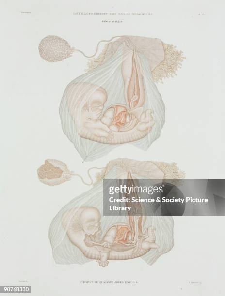 Engraved colour plate by Protais, showing a human foetus at approximately 40 days of development. From the atlas edition of �Histoire Generale et...