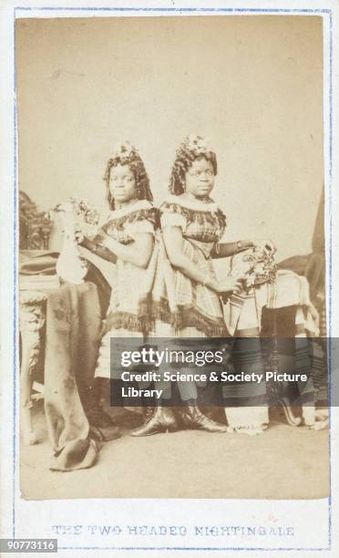 Carte de visite of �The Two-Headed Nightingale�. Millie and Christine McKay were connected at the base of the spine. Born into slavery in America's...