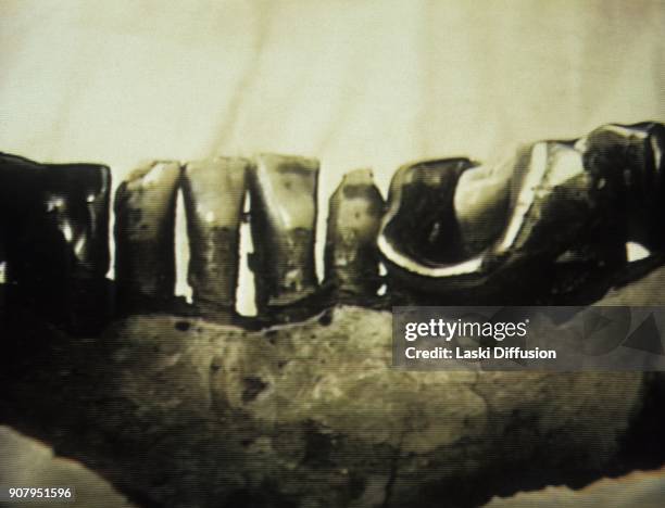 Hitler's jawbone is kept at the Federal Security Service of the Russian Federation archive from the end of the World War II and seems to be the only...