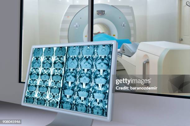 medical scan monitor - diagnostic medical tool stock pictures, royalty-free photos & images