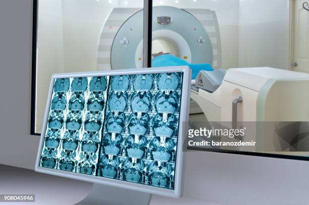 medical scan monitor - tomografia por emissão de positrões imagens e fotografias de stock