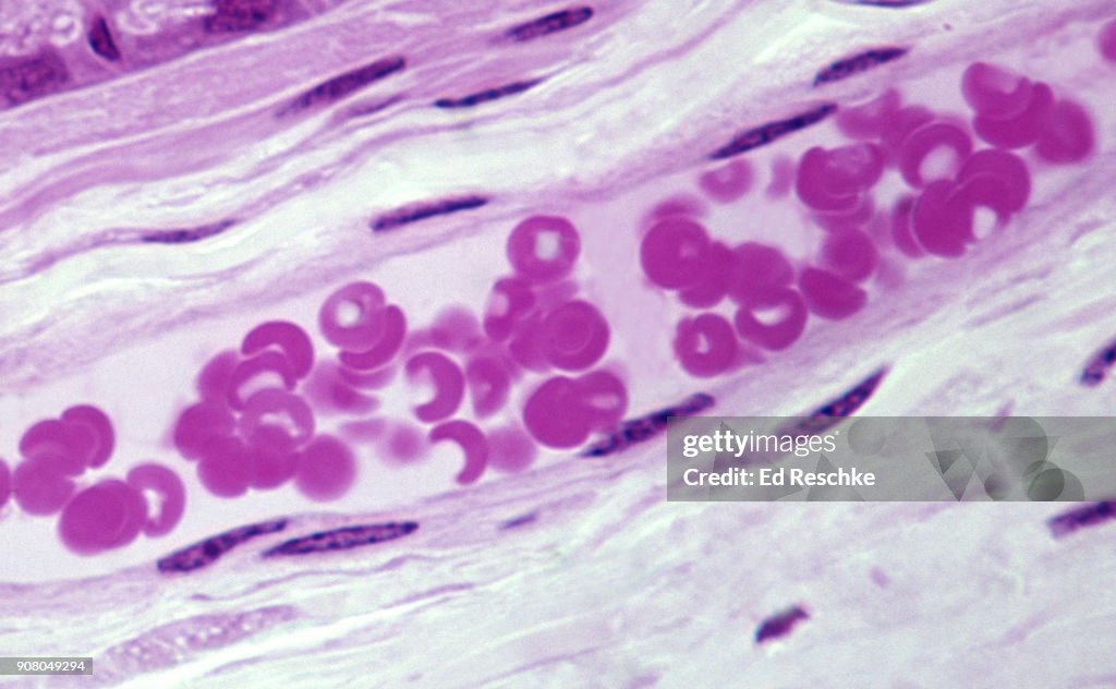 BLOOD VESSEL (VENULE) with numerous RED BLOOD CELLS (ERYTHROCYTES) longitudinal section, 250X