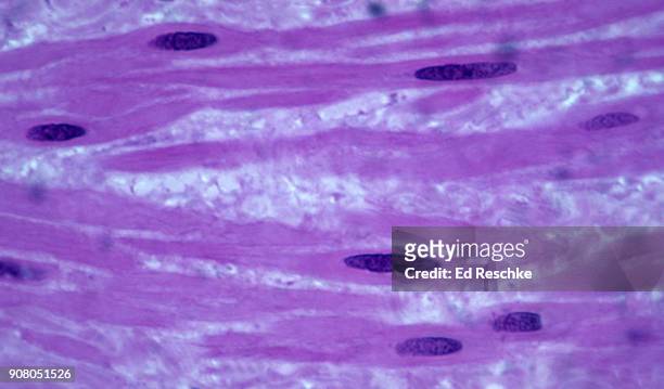 smooth muscle fibers (or cells) in a blood vessel wall, 250x - muscle cell stock pictures, royalty-free photos & images