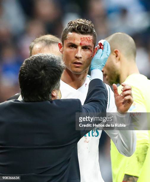 Cristiano Ronaldo of Real Madrid CF is looked after following an injury during the La Liga match between Real Madrid CF and Deportivo La Coruna at...