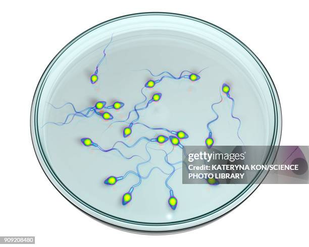 in vitro fertilization concept, illustration - sperm stock illustrations