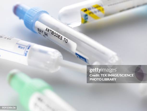 Autoimmune Injections Autoimmune Disease Photos and Premium High Res Pictures - Getty Images
