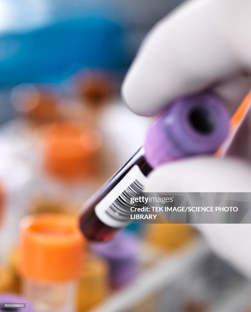 Medical Sample Collection Blood Samples High-Res Stock Photo - Getty Images