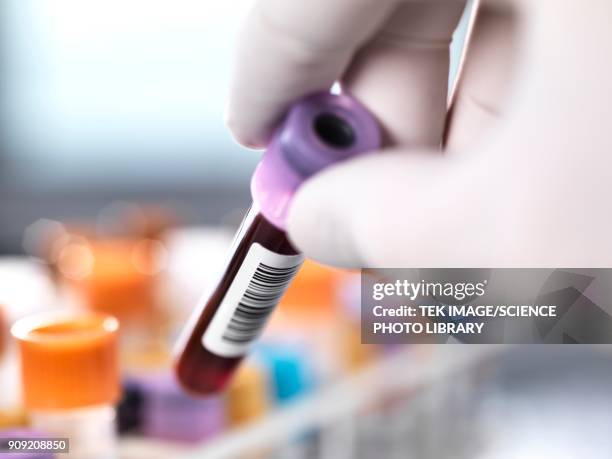 health screening - analisis de sangre fotografías e imágenes de stock