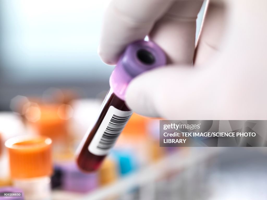 Health screening