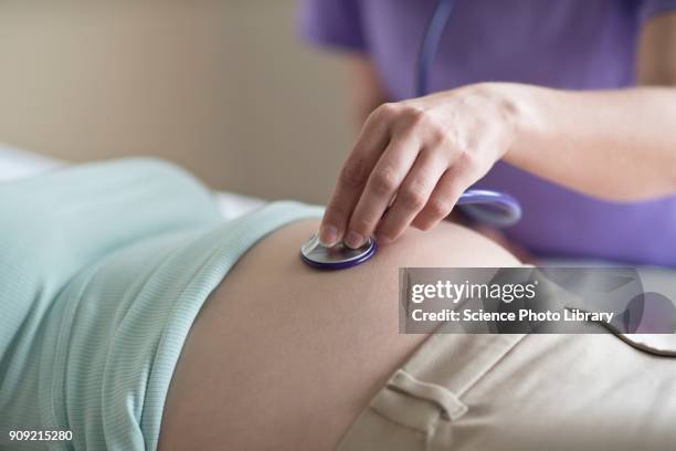 midwife listening to babys heartbeat - mid wife stock pictures, royalty-free photos & images