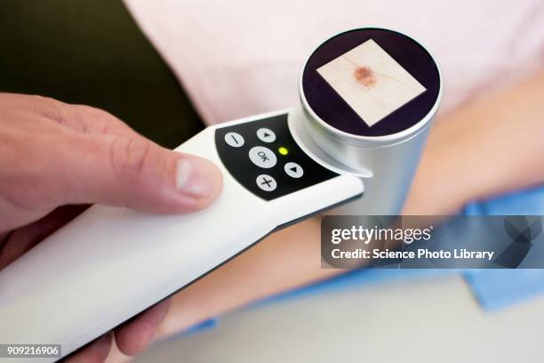 examining mole on patients arm - mole skin stock pictures, royalty-free photos & images