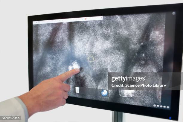 doctor pointing at computer monitor in skin clinic - stratum corneum imagens e fotografias de stock