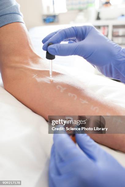 patient undergoing a skin prick test - allergietest stock-fotos und bilder