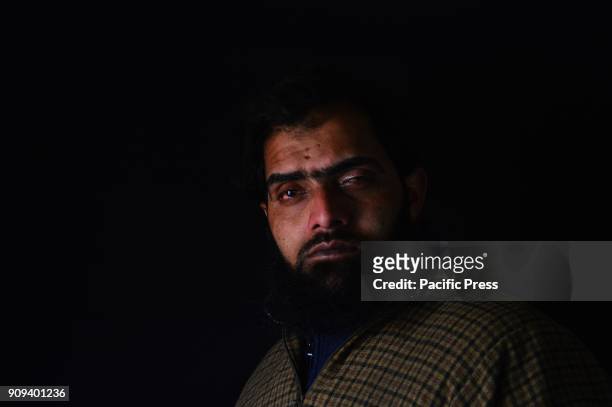 Firdous Ahmad Dar, 26 a resident of Mazbugh village of Sopore in North Kashmir's Baramulla district left his home to get bread in 2016 mass uprising,...