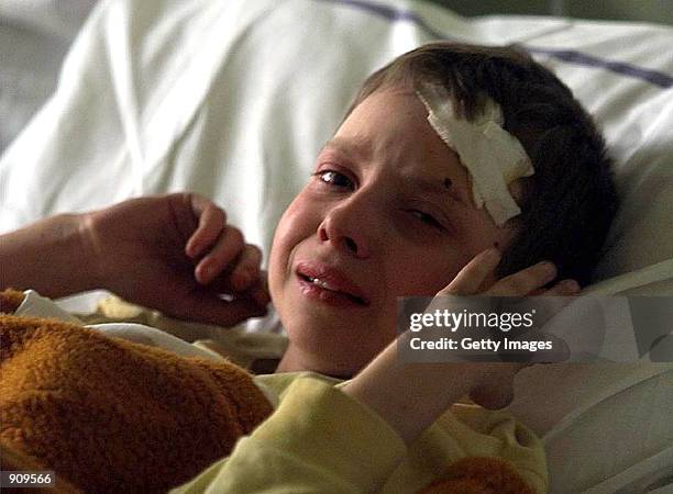 An injured Serb boy, Marko Miladinovic, cries in his hospital bed in Aleksinac, some 200 kilometers south of Belgrade, Yugoslavia, early Tuesday,...