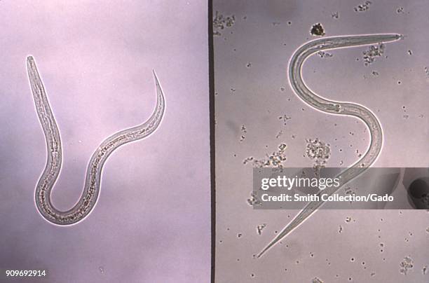 Hookworm and strongyloides filariform infective stage larvae revealed in the micrograph film, 1980. Image courtesy Centers for Disease Control / Dr...