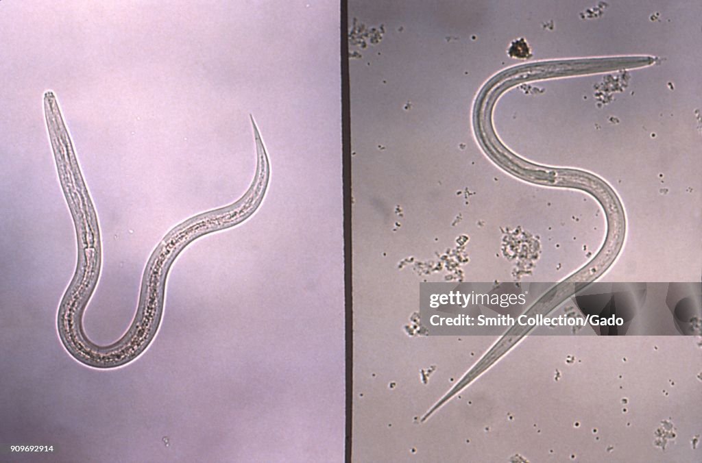 Hookworm And Strongyloides