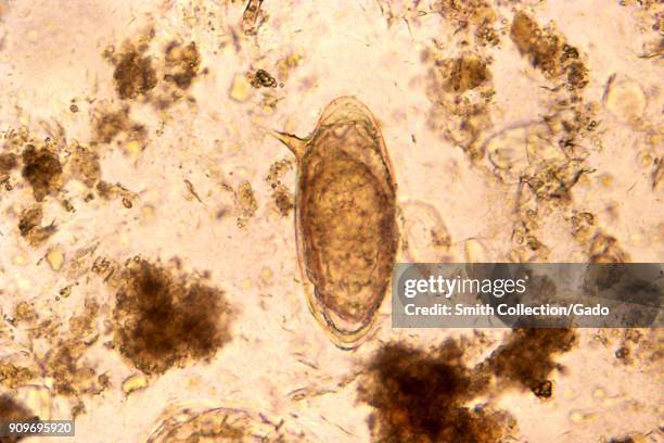 Schistosoma mansoni trematode egg form revealed in the micrograph film, 1986. Image courtesy Centers for Disease Control .