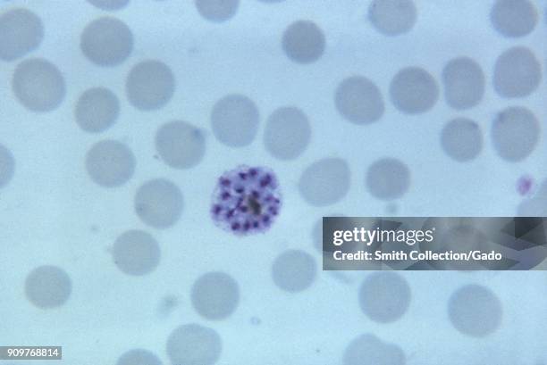 Photomicrograph of the malaria parasite Plasmodium vivax in its mature schizont phase with 18 merozoites, on thin blood smear magnified 1125x, 1965.