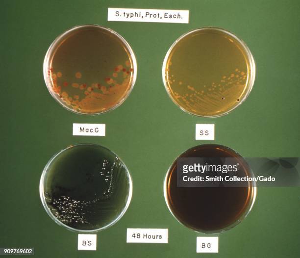 Photograph of four Petri dishes with the same bacteria cultured on different media , after 48 hours of incubation, 1964. Image courtesy CDC/DR. W. H....