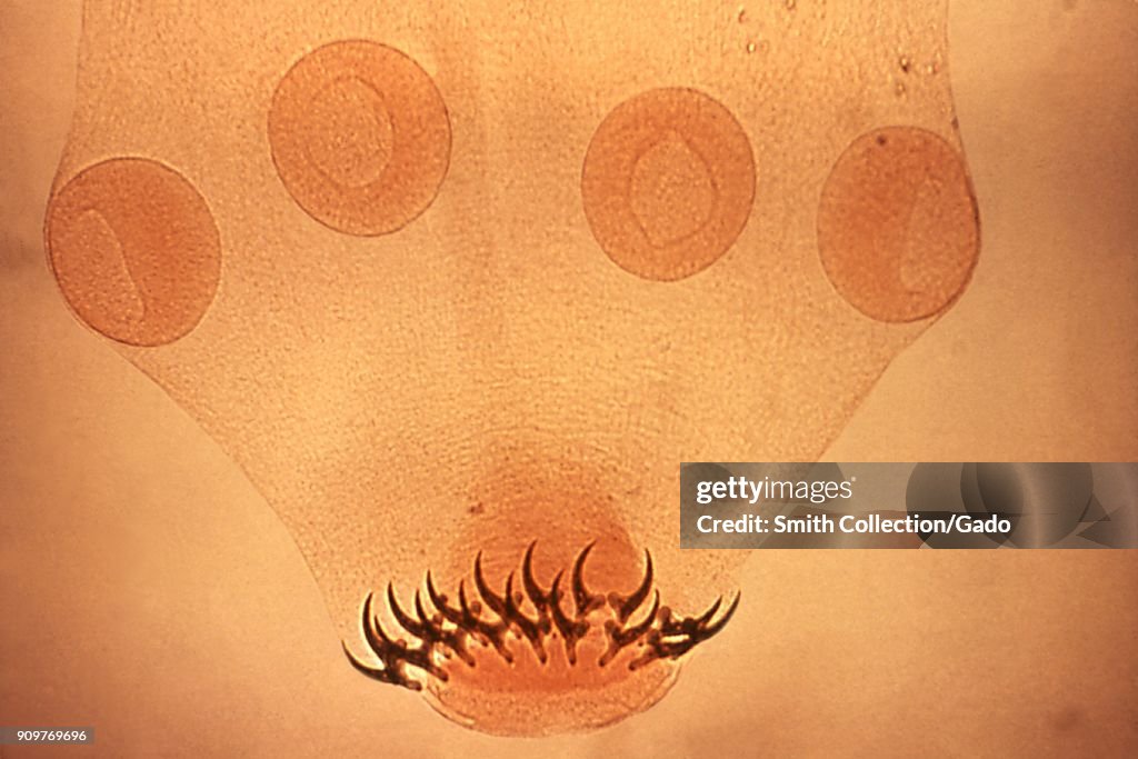 Tapeworm Scolex
