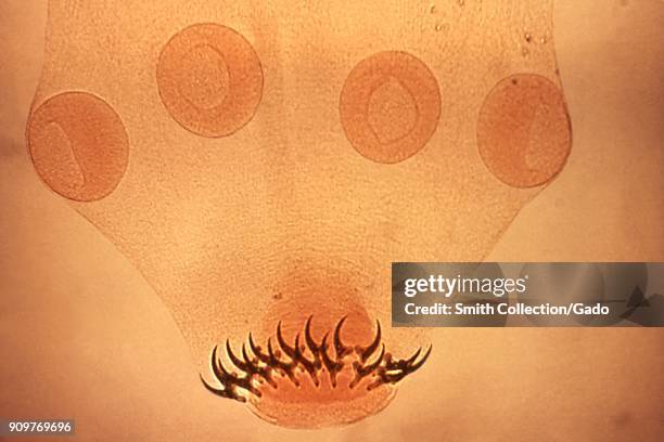 Tapeworm scolex four suckers morphology revealed in a micrograph film, 1986. Image courtesy Centers for Disease Control .