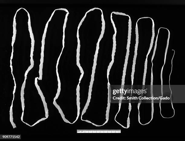 Adult tapeworm in the human intestine, 1986. Image courtesy Centers for Disease Control .