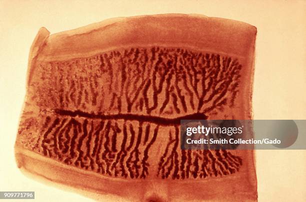 Tapeworm morphology of a gravid proglottid revealed in a micrograph film, 1986. Image courtesy Centers for Disease Control .