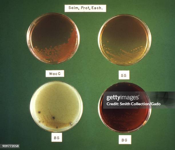 Photograph of four Petri dishes with the same bacteria cultured on different media , after 24 hours of incubation, 1964. Image courtesy CDC/DR. W. H....