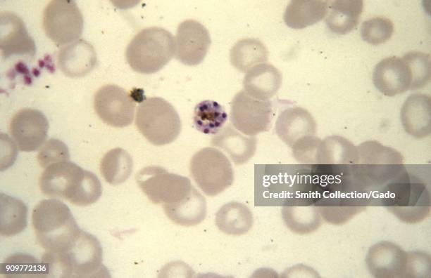 Photomicrograph of the malaria parasite Plasmodium malariae in schizont phase with 10 merozoites, on thin blood smear, 1965. Image courtesy CDC/Dr....