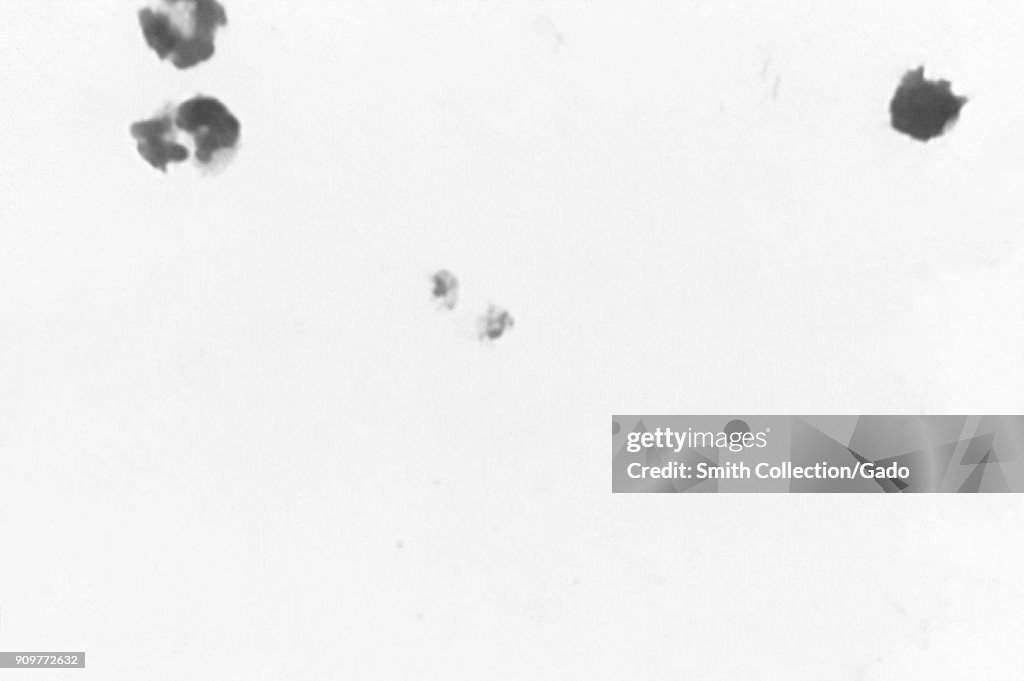 Plasmodium Malariae Trophozoite