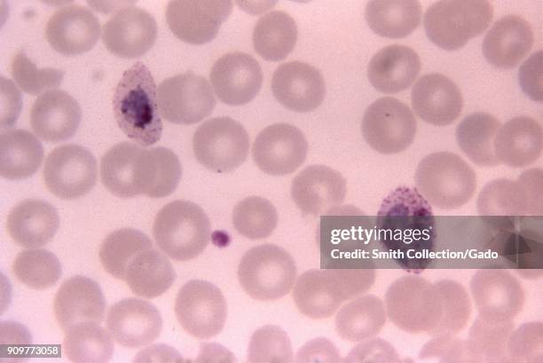 Photomicrograph of the malaria parasite Plasmodium Ovale growing as a double trophozoite in one red blood cell and a single trophozoite, on a thin...