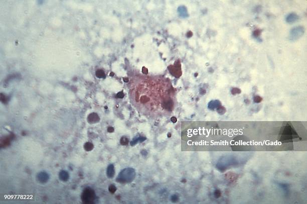 Intracellular Rocky Mountain spotted fever bacteria revealed in a micrograph film, 1954. Image courtesy Centers for Disease Control .