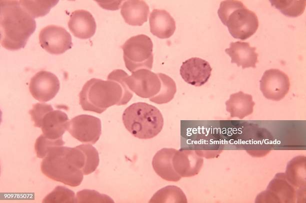 Photomicrograph of a blood sample with the malaria causing parasite Plasmodium vivax, in its ring phase, 1972. Image courtesy CDC/Dr. Mae Melvin.