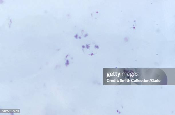 Photomicrograph of the malaria parasite Plasmodium vivax in trophozoite phase without Schuffner's dots, on thick film, magnified 1125x, 1973. Image...