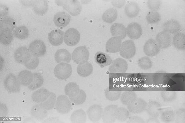 Photomicrograph of an immature Plasmodium falciparum schizont and a ring form, parts of the parasite that causes malaria, 1963. Image courtesy CDC/N....