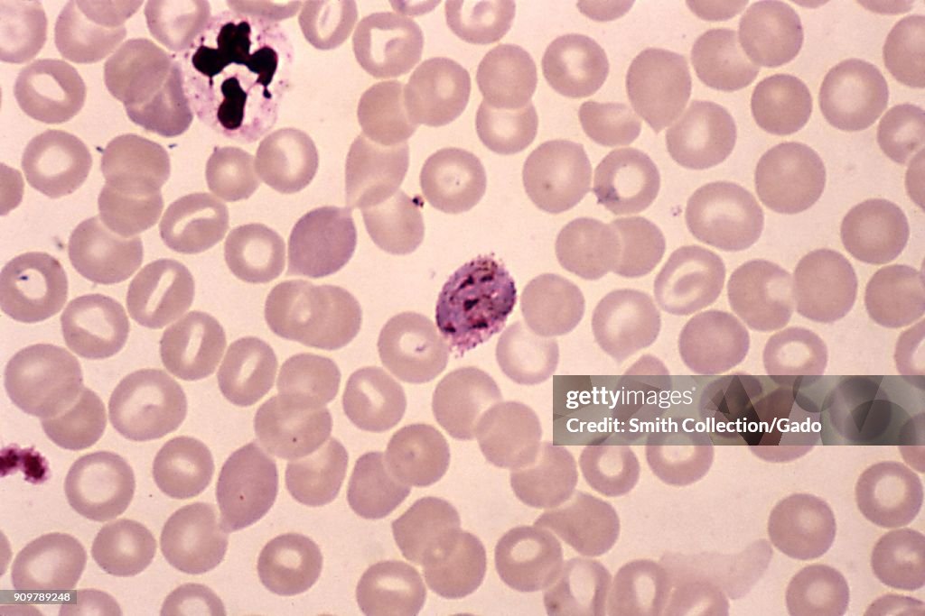 P. Vivax Schizont