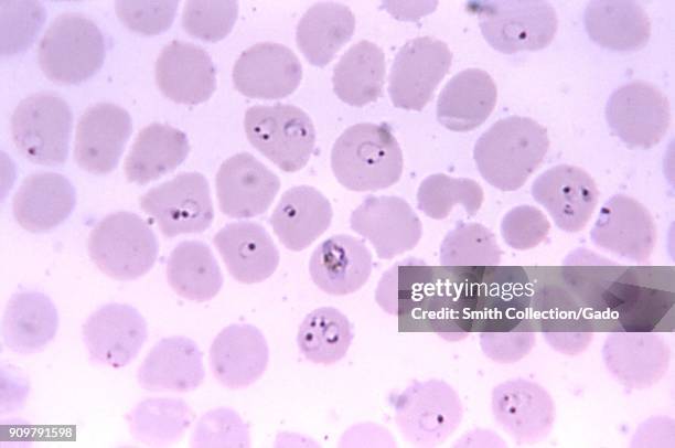 Photomicrograph of Plasmodium falciparum, the parasite that causes malaria, and a growing trophozoite, 1971. Image courtesy CDC.