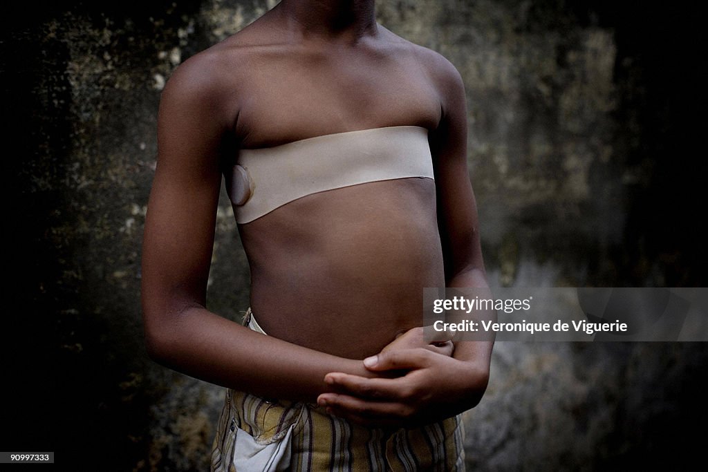 Breast Ironing in Cameroon