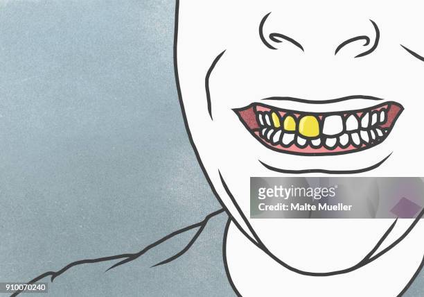 cropped image of man with gold tooth against gray background - gold tooth stock-fotos und bilder