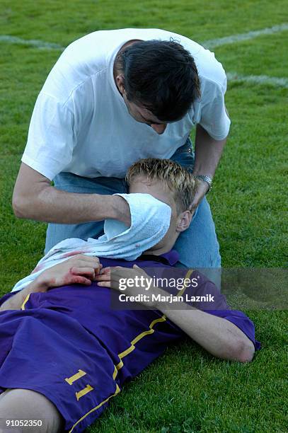 ferita calciatore - head injury foto e immagini stock