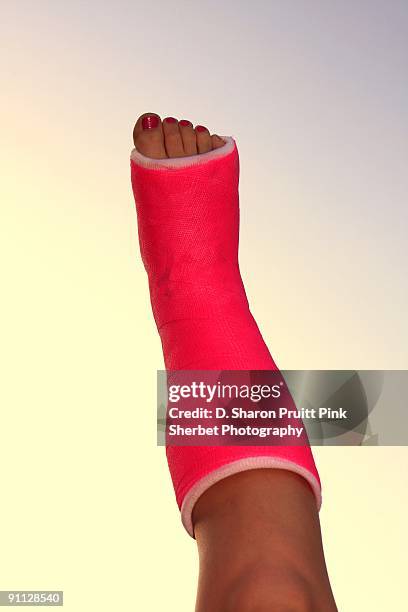 neon pink plaster cast on girl's broken foot - baby gate stock pictures, royalty-free photos & images