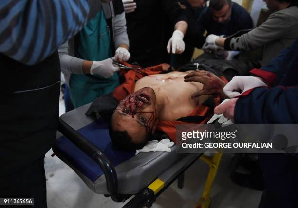 Kurdish man, wounded following a Turkish airstrike on a village in the Afrin district, receives treatment on January 28 in the Afrin hospital. Turkey...